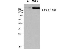 Western blot analysis of KB MCF-7 using p-IRS-1 (Y896) antibody.