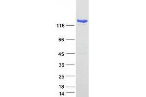 Validation with Western Blot