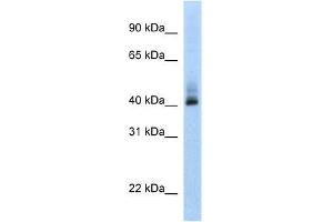 Human MCF-7; WB Suggested Anti-ANKRD42 Antibody Titration: 0. (ANKRD42 anticorps  (N-Term))