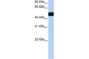 WB Suggested Anti-CROCCL2 Antibody Titration:  0. (CROCCP3 anticorps  (N-Term))
