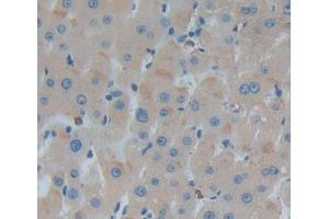 anti-Alanine Glyoxylate Aminotransferase (AGXT) (AA 187-741) antibody