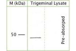 WB on rat trigeminal lysate (10% gel, 1:29. (NGFR anticorps  (Extracellular Domain))