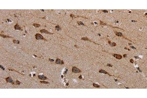 Immunohistochemistry of paraffin-embedded Human brain tissue using PLXNB1 Polyclonal Antibody at dilution 1:40