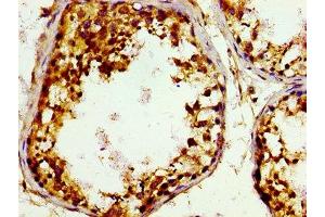 Immunohistochemistry of paraffin-embedded human testis tissue using ABIN7148935 at dilution of 1:100 (GAK anticorps  (AA 939-1086))