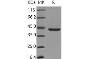 Western Blotting (WB) image for Pepsinogen C (PGC) protein (His tag) (ABIN7197294) (PGC Protein (His tag))