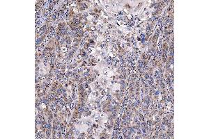 IHC analysis of TTC7B using anti-TTC7B antibody (ABIN7601050). (TTC7B anticorps  (AA 275-730))