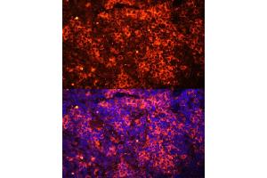 Immunofluorescence analysis of mouse spleen using TLR8 Polyclonal Antibody (ABIN3022014, ABIN3022015, ABIN3022016, ABIN1513616 and ABIN6218568) at dilution of 1:100 (40x lens).