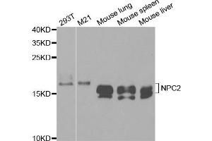 Western Blotting (WB) image for anti-Niemann-Pick Disease, Type C2 (NPC2) antibody (ABIN1876601) (NPC2 anticorps)
