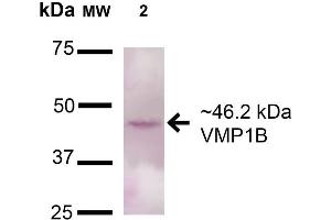Western blot analysis of Rat Pancreas cell lysates showing detection of 46. (VMP1 anticorps  (AA 391-402) (PE))