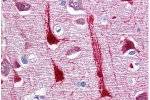 Human Brain, cortex: Formalin-Fixed, Paraffin-Embedded (FFPE) (CRYM anticorps  (AA 215-315))