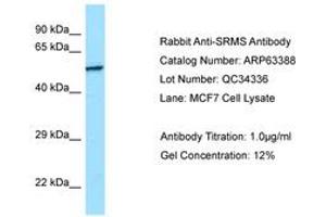 Image no. 1 for anti-Src-Related Kinase Lacking C-Terminal Regulatory Tyrosine and N-Terminal Myristylation Sites (SRMS) (C-Term) antibody (ABIN6749978) (SRMS anticorps  (C-Term))