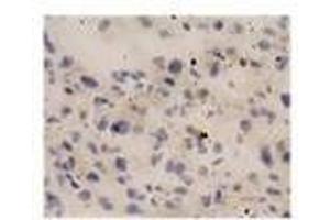 Image no. 1 for anti-Interleukin 18 (IL18) antibody (ABIN791564) (IL-18 anticorps)