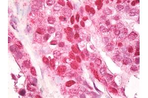 Anti-CNOT4 / CLONE243 antibody IHC of human prostate. (CNOT4 anticorps  (AA 50-100))