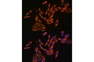 Immunofluorescence analysis of NIH/3T3 cells using UB Rabbit mAb (ABIN7271128) at dilution of 1:50 (40x lens). (UBA52 anticorps)