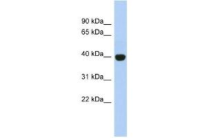 KIAA1191 antibody used at 1 ug/ml to detect target protein.
