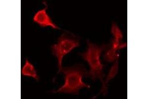 ABIN6275946 staining HeLa by IF/ICC.