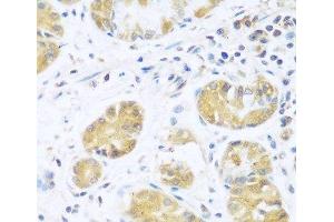 Immunohistochemistry of paraffin-embedded Human stomach using UCHL3 Polyclonal Antibody at dilution of 1:100 (40x lens). (UCHL3 anticorps)