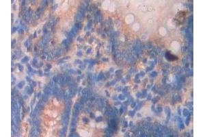 Detection of SPTAN1 in Rat Small intestine Tissue using Polyclonal Antibody to Alpha-Fodrin (SPTAN1)