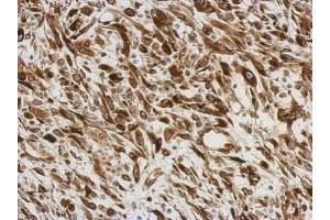 IHC-P Image Immunohistochemical analysis of paraffin-embedded C2C12 xenograft, using AGR3, antibody at 1:500 dilution. (AGR3 anticorps  (Center))