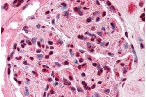 Human Kidney (formalin-fixed, paraffin-embedded) stained with FOXJ1 antibody ABIN214756 at 5 ug/ml followed by biotinylated goat anti-rabbit IgG secondary antibody ABIN481713, alkaline phosphatase-streptavidin and chromogen.