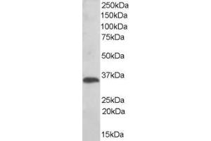 ABIN184598 (0. (TMX1 anticorps  (C-Term))