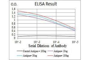 Black line: Control Antigen (100 ng), Purple line: Antigen(10 ng), Blue line: Antigen (50 ng), Red line: Antigen (100 ng),