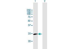 Western Blot analysis of MYLC2PL expression in transfected 293T cell line by MYLC2PL MaxPab polyclonal antibody. (MYL10 anticorps  (AA 1-226))