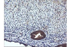 Image no. 4 for anti-Mitogen-Activated Protein Kinase Kinase 1 (MAP2K1) antibody (ABIN1499394) (MEK1 anticorps)