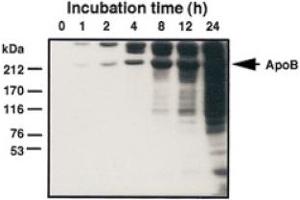 Western Blot analysis of MDA-LDL adduct formation. (Malondialdehyde anticorps)