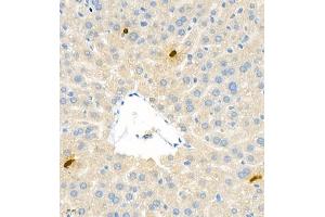 Immunohistochemistry analysis of paraffin embedded mouse liver using S100A9 (ABIN7075497) at dilution of 1: 1800