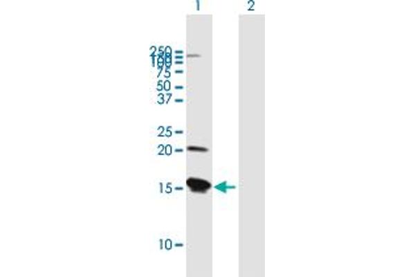 VAMP8 anticorps  (AA 1-100)