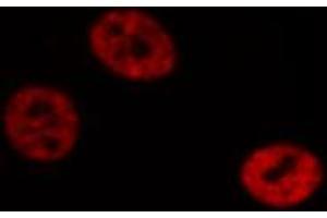 ABIN6272422 staining Hela by IF/ICC. (RTCD1 anticorps  (C-Term))