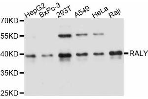Western blot analysis of extracts of various cell lines, using RALY antibody. (Raly anticorps  (AA 96-306))