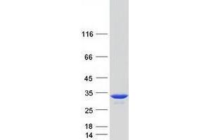 Triosephosphate Isomerase 1 (TPI1) protein (Myc-DYKDDDDK Tag)