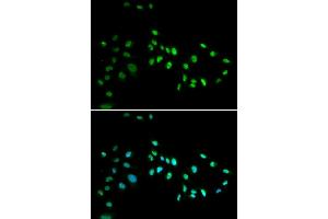 Immunofluorescence analysis of A549 cell using DNMT3A antibody. (DNMT3A anticorps)