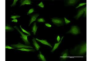 Immunofluorescence of monoclonal antibody to PURA on HeLa cell. (PURA anticorps  (AA 183-292))