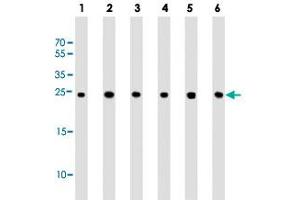 Western blot analysis of Lane 1: human liver lysates Lane 2: Hela whole cell lysates Lane 3: HepG2 whole cell lysates Lane 4: MCF-7 whole cell lysates Lane 5: Neuro-2a whole cell lysates Lane 6: PC-12 whole cell lysates reacted with PSMA5 monoclonal antibody  at 1:1000 dilution. (PSMA5 anticorps)