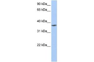 WB Suggested Anti-TMCC1 Antibody Titration:  0. (TMCC1 anticorps  (C-Term))