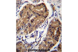 Immunohistochemistry (IHC) image for anti-Deleted in Colorectal Carcinoma (DCC) antibody (ABIN2996670) (DCC anticorps)