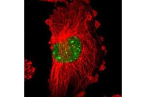 Immunofluorescent staining of U-251 MG with MYST4 polyclonal antibody  (Green) shows positivity in nucleus. (KAT6B anticorps)