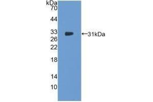 Detection of Recombinant NOSTRIN, Human using Polyclonal Antibody to Nitric Oxide Synthase Trafficker (NOSTRIN) (NOSTRIN anticorps  (AA 18-251))