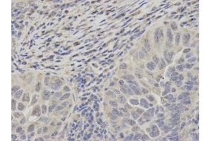 Immunohistochemistry (IHC) image for anti-Proteasome (Prosome, Macropain) 26S Subunit, ATPase, 2 (PSMC2) antibody (ABIN1874379) (PSMC2 anticorps)