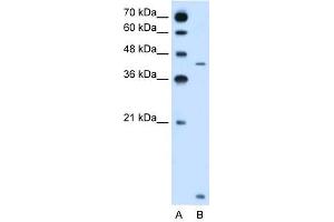 anti-Solute Carrier Family 46, Member 3 (SLC46A3) (N-Term) antibody
