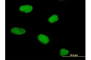 Immunofluorescence of purified MaxPab antibody to PRR6 on HeLa cell.