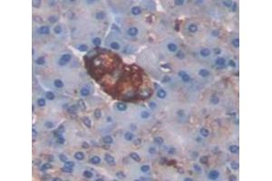 Figure. (LGALS9C anticorps  (AA 228-356))