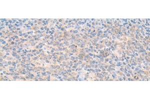 Immunohistochemistry of paraffin-embedded Human tonsil tissue using SMS Polyclonal Antibody at dilution of 1:70(x200) (SMS anticorps)
