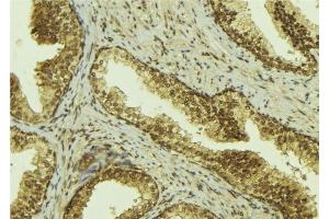 ABIN6274371 at 1/100 staining Mouse colon tissue by IHC-P. (MED1 anticorps  (C-Term))