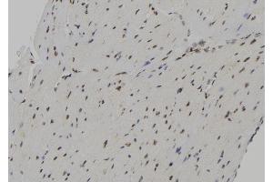 ABIN6267148 at 1/100 staining Mouse heart tissue by IHC-P.