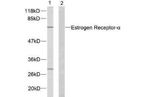Western blot analysis of extracts from MCF7 cells using Estrogen Receptor-α (Ab-167) antibody (E021068). (Estrogen Receptor alpha anticorps)