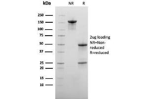 SDS-PAGE Analysis Purified CD73 Mouse Monoclonal Antibody (NT5E/2545).
